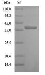 Arabidopsis thaliana CDKB1-2 Protein (Recombinant 6His, N-terminus)