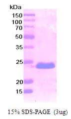 Human PDPN / Podoplanin Protein (Recombinant His)