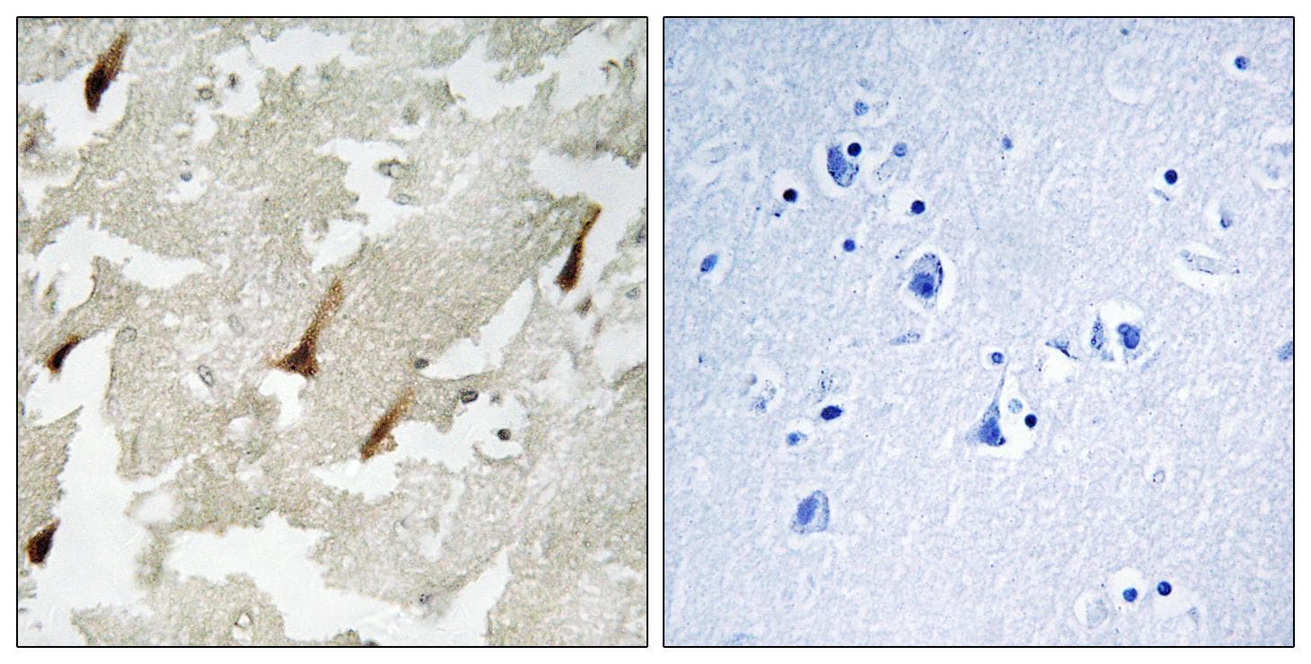 GPRIN2 / GRIN2 Antibody