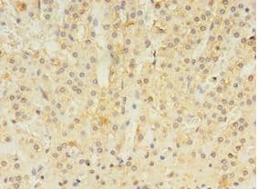 ALDH3B2 Antibody (aa57-311)
