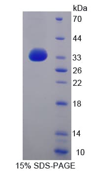 Mouse ITGB4 / Integrin Beta 4 Protein (Recombinant His-T7)