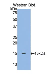 TGFB2 / TGF Beta2 Antibody (aa331-442)