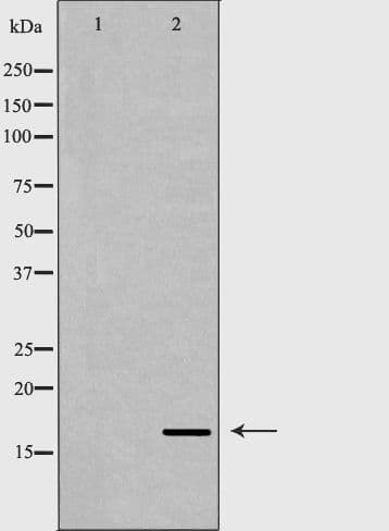Polyclonal Rabbit anti-Human Angiogenin / ANG Antibody (IHC, WB)