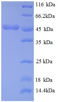 E. coli metC Protein (Recombinant His)