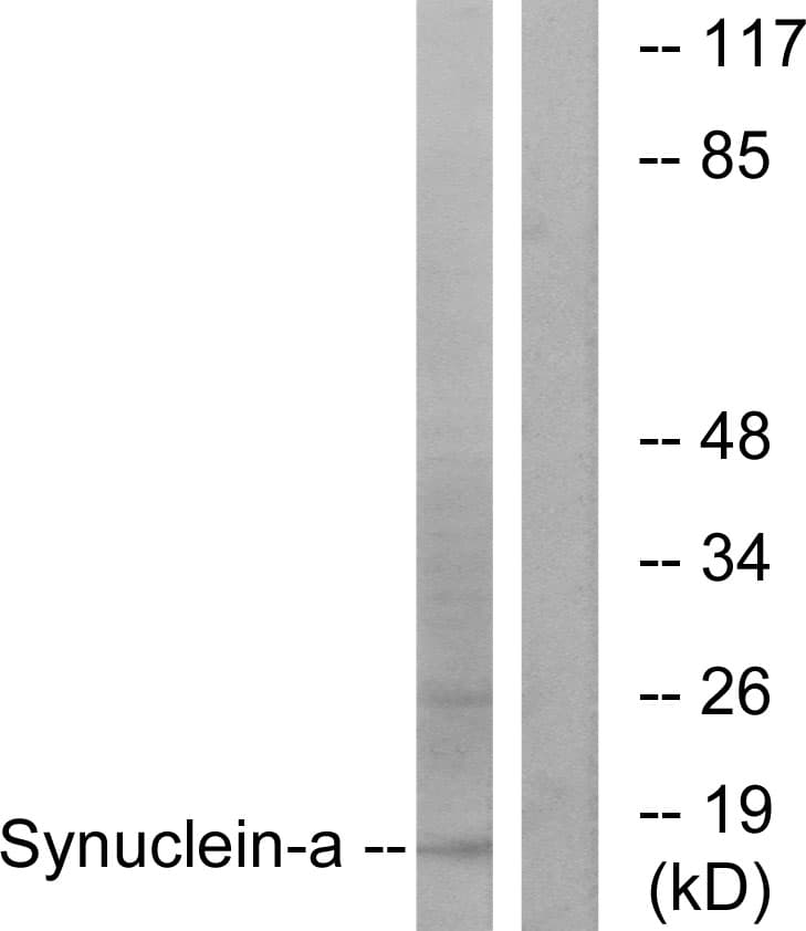 SNCA / Alpha-Synuclein Antibody (aa91-140)