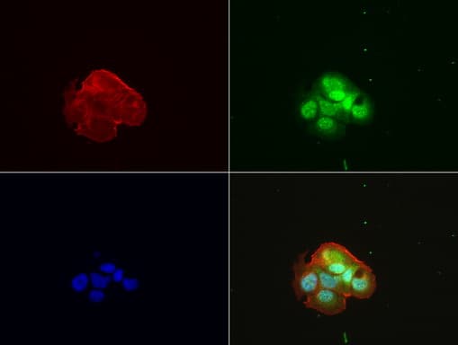 ZSCAN18 / ZNF447 Antibody (clone UMAB113)