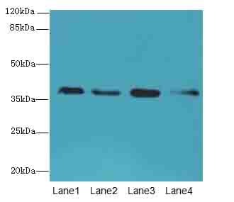 Polyclonal Rabbit anti-Human SFXN4 Antibody (IHC, WB)