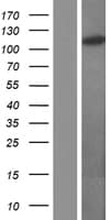 OGT / O-GLCNAC Protein (Over-Expression Lysate Myc-DDK (Flag))
