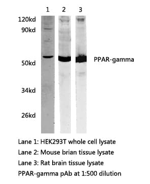 PPARG / PPAR Gamma Antibody