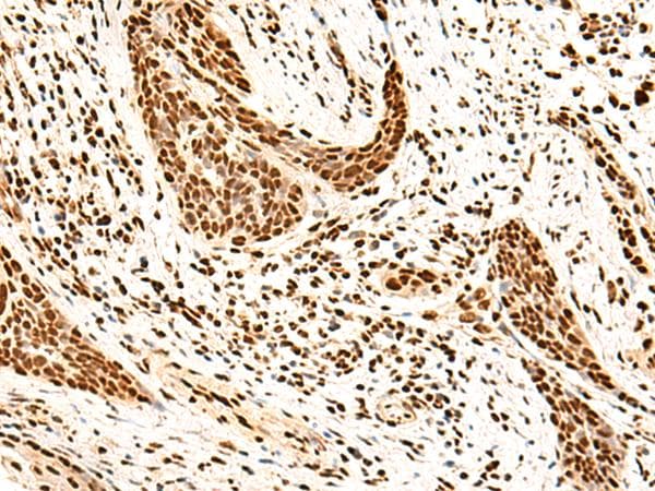 SNRPB2 Antibody