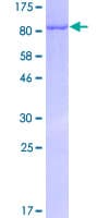 Human GAD1 / GAD67 Protein (Recombinant GST)