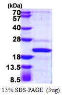 Human AP1S2 Protein (Recombinant His)