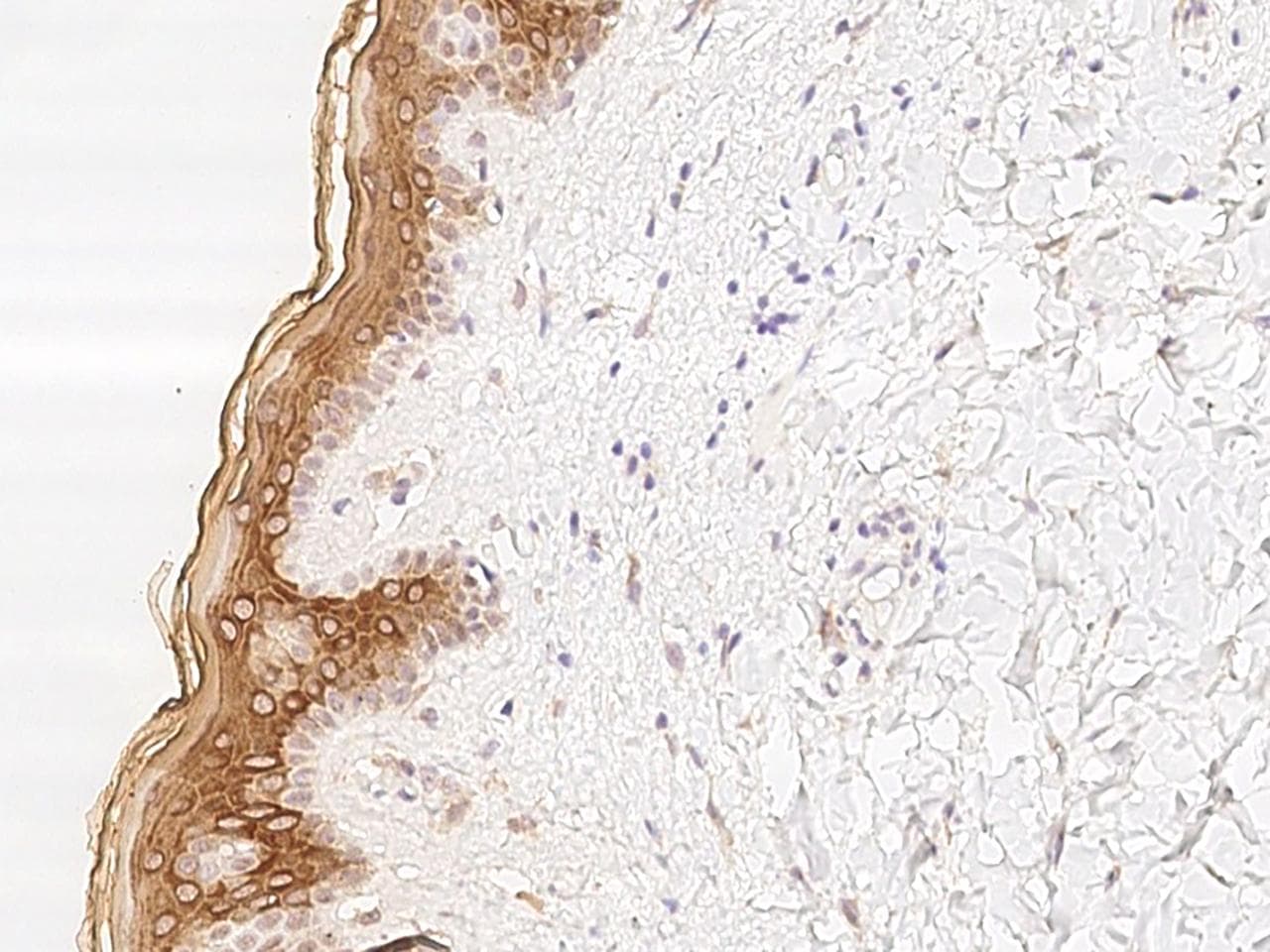 TCHHL1 Antibody