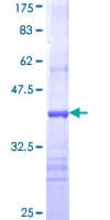 Human CHAT Protein (Recombinant GST, N-terminus)