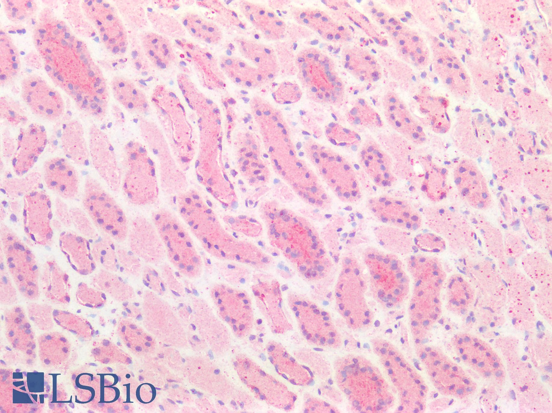 IHC-plus™ BCL2 / Bcl-2 Antibody