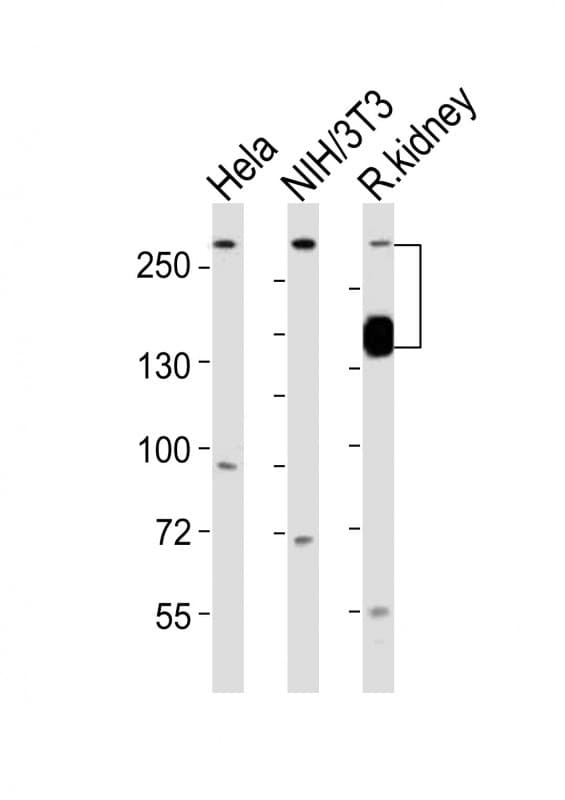 SPTAN1 / Alpha Fodrin Antibody (aa977-991)