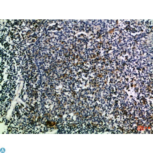 CD274 / B7-H1 / PD-L1 Antibody