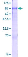 Human ZFP3 Protein (Recombinant GST)