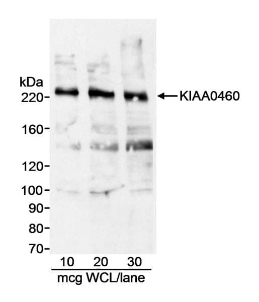 RPRD2 Antibody (aa700-750)