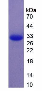 Mouse APOM / Apolipoprotein M (Recombinant 6His, N-terminus)
