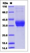 Human KDR / VEGFR2 / FLK1 Protein (Recombinant His,C-terminus)