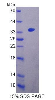 Mouse ACAA2 Protein (Recombinant His-T7, N-terminus)