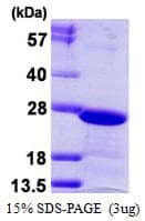 Human CBX3 / HP1 Gamma Protein (Recombinant His)
