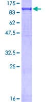 Human PFKP Protein (Recombinant GST)