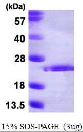 Human FGF10 Protein (Recombinant His)