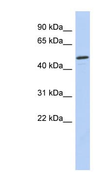 Polyclonal Rabbit anti-Human CHEK1 / CHK1 Antibody (aa251-300, WB)