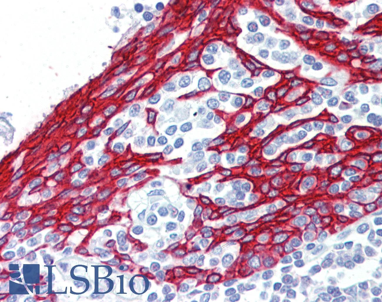 IHC-plus™ KRT13 / CK13 / Cytokeratin 13 Antibody (aa444-458)