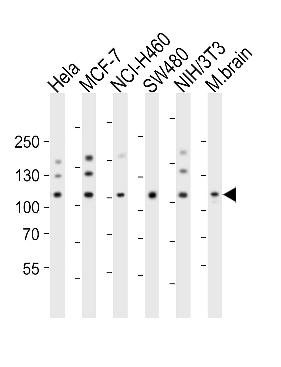 Polyclonal Rabbit anti-Human EPHA4 / EPH Receptor A4 Antibody (aa383-417, WB)