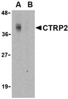 C1QTNF2 / CTRP2 Antibody