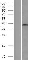 WDR45L Protein (Over-Expression Lysate Myc-DDK (Flag))