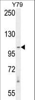 RASAL3 Antibody (aa947-975)