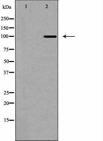 Polyclonal Rabbit anti-Human DNMT3A Antibody (IHC, WB)