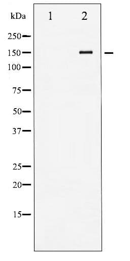 Polyclonal Rabbit anti-Human KDR / VEGFR2 / FLK1 Antibody (phospho-Tyr1214, IHC, WB)