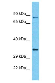 C10orf71 Antibody (aa609-658)