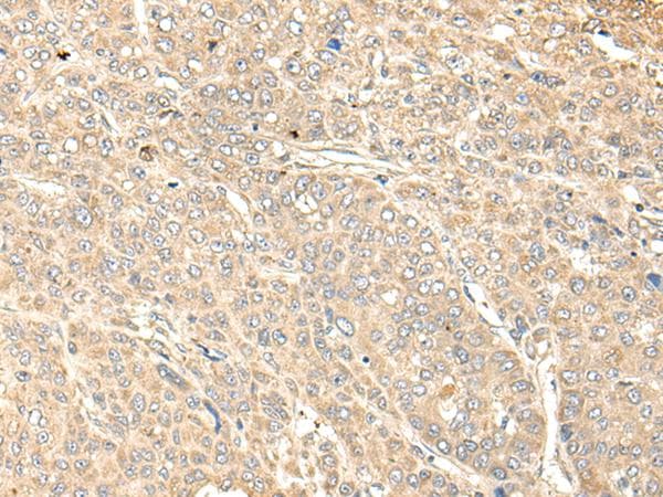 WDFY4 Antibody