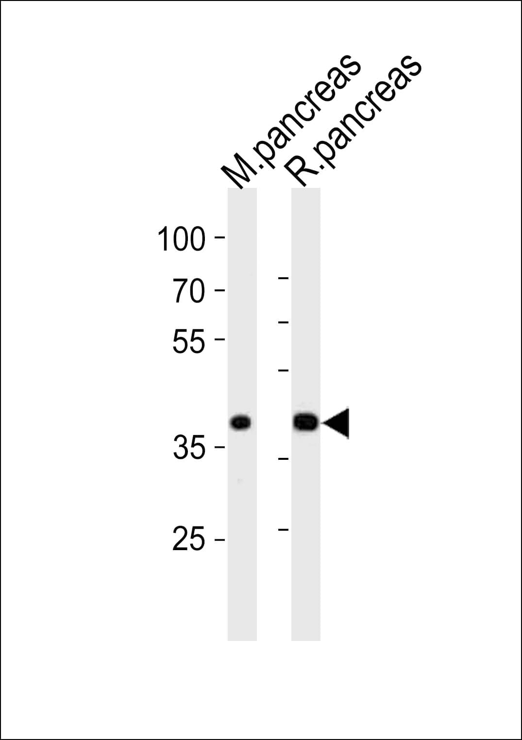 PDX1 Antibody (aa21-55)