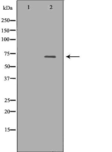 ALB / Serum Albumin Antibody