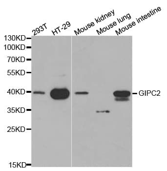GIPC2 Antibody (aa1-315)