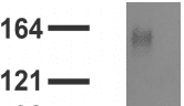 ABCC8 / SUR1 Antibody (clone S289-16)