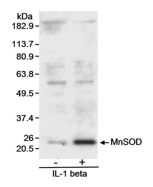 SOD2 / Mn SOD Antibody (aa75-125)