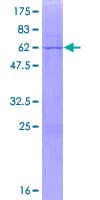 Human AIMP2 Protein (Recombinant GST)