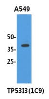TP53I3 / PIG3 Antibody (clone AT1C9)