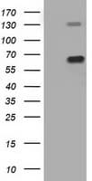 PKLR Antibody (clone OTI1B4)