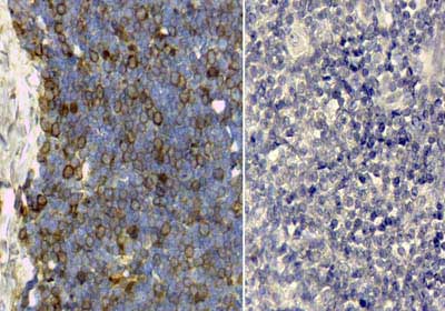 TF / Transferrin Antibody (Lyophilized)