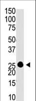 GCAP / GUCA1A Antibody (aa160-191)