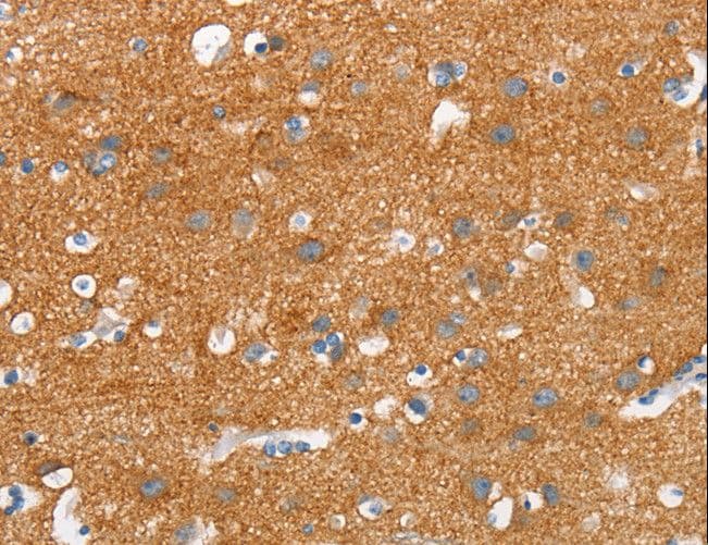 Polyclonal Rabbit anti-Human SNCA / Alpha-Synuclein Antibody (IHC)